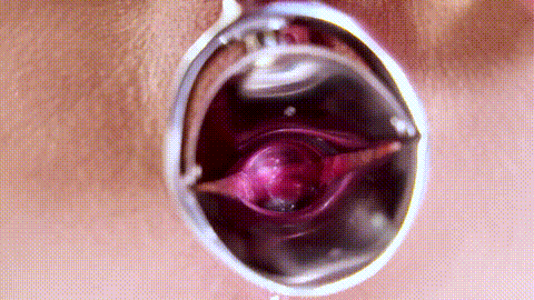 011226_01-10MU_p60.gif