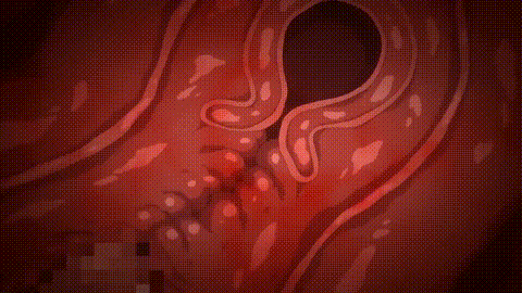 10588369_1080p_p60.gif